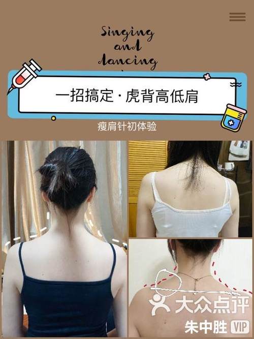 74549.cσm查询开奖记录和女子打瘦肩针险丧命与有打过瘦肩针的美女吗